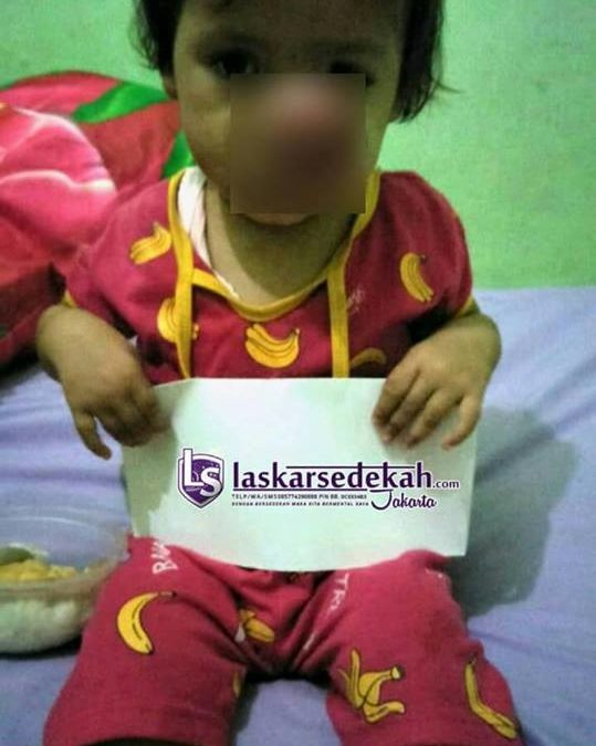 LS Jakarta : Eksekusi Sedekah kepada Nurasyfa (2 tahun) yang menderita tumor ganas pada hidungnya di Desa Jayabakti, Kab. Bekasi | Ahad, 14 April 2019